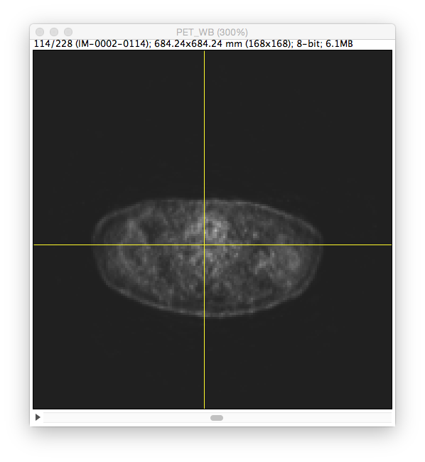 リアルタイムXYZ画像合成ソフト XYZview(イグジービュー